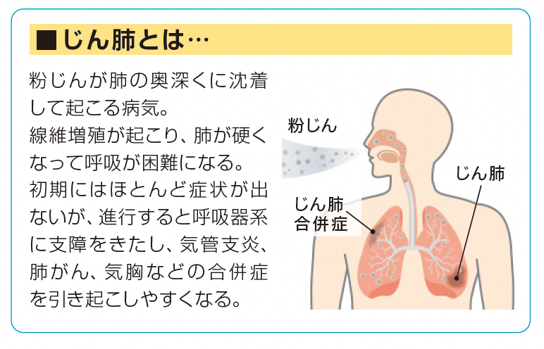 じん肺とは